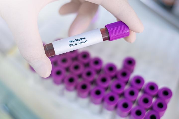 Secretaría de Salud emite recomendaciones sobre el Mpox