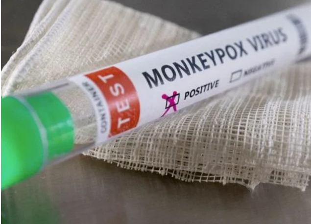 Casos sospechosos de viruela del mono en Campeche