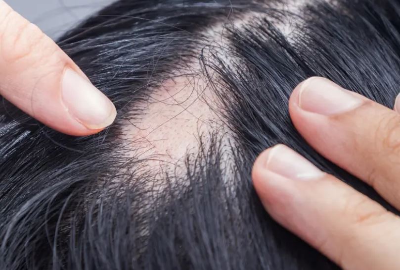 La alimentación influye directamente en la salud capilar