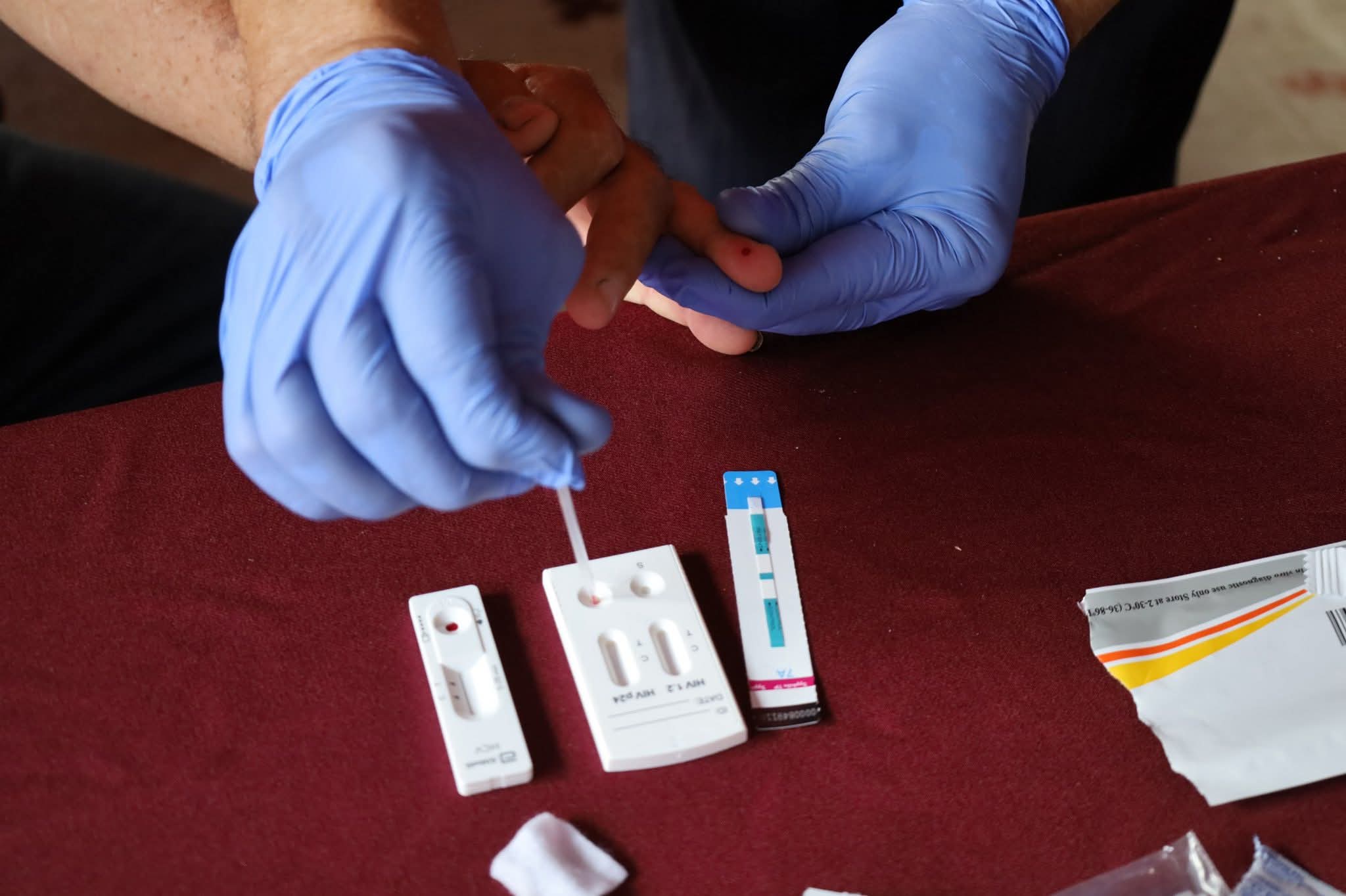 Reduce registro de casos de VIH en Tlaxcala hasta mediados de 2025