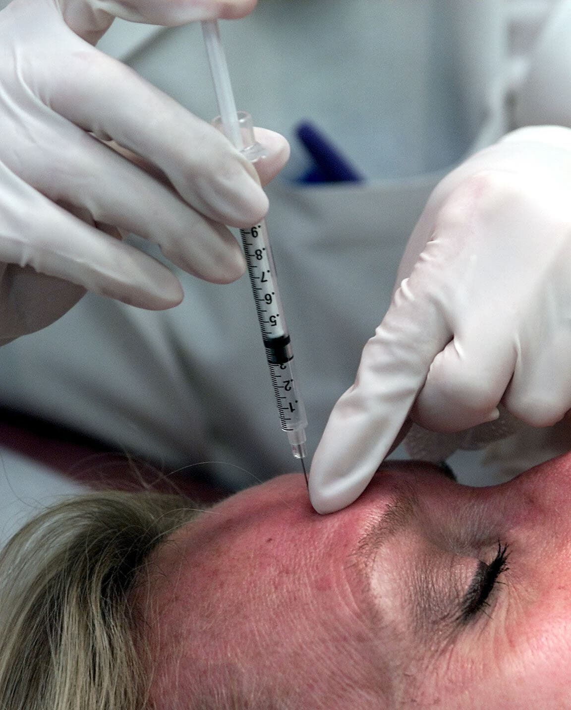 Spas en Tlaxcala tienen prohibido aplicar inyecciones; advierten riesgos a la salud