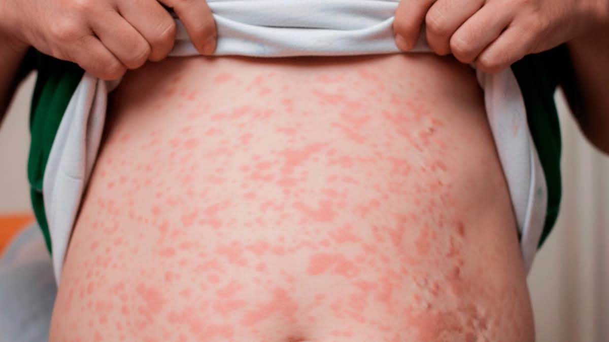 Confirma SESA muerte de menor de edad en Hospital Infantil de Tlaxcala