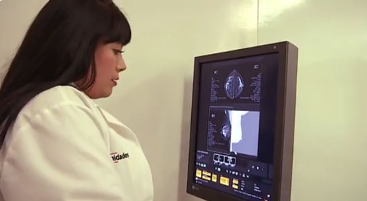 Tlaxcala sorprende a México: es el estado con menos casos de cáncer de cuello uterino en 2025