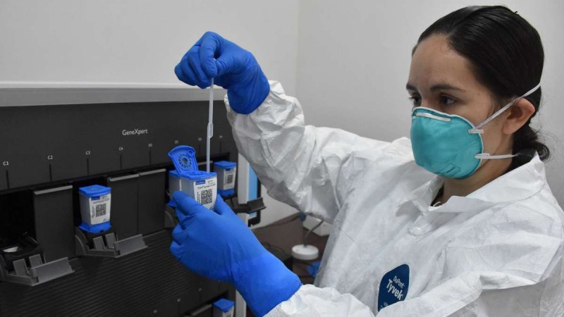 Harán pruebas domiciliarias de Covid-19 en Laboratorios del Chopo