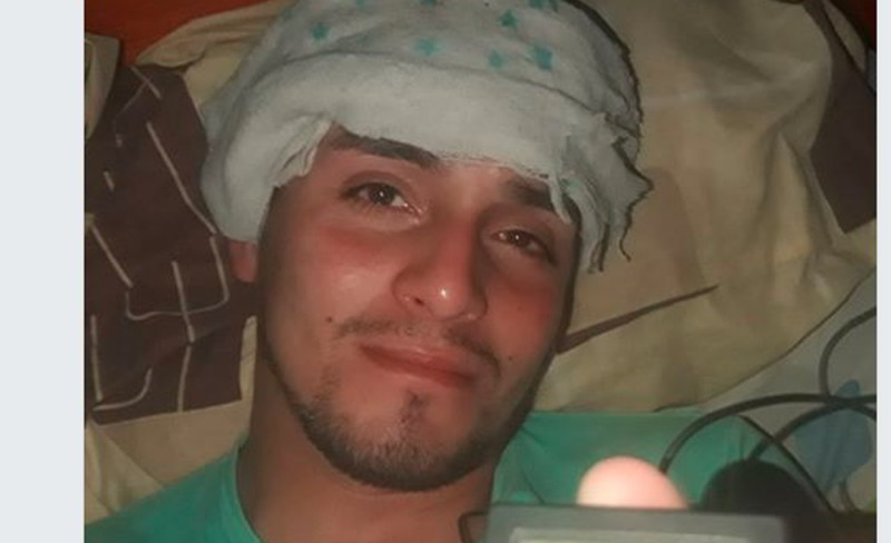 De mal en peor; hombre se aisla por COVID-19 pero le pica un mosquito con dengue