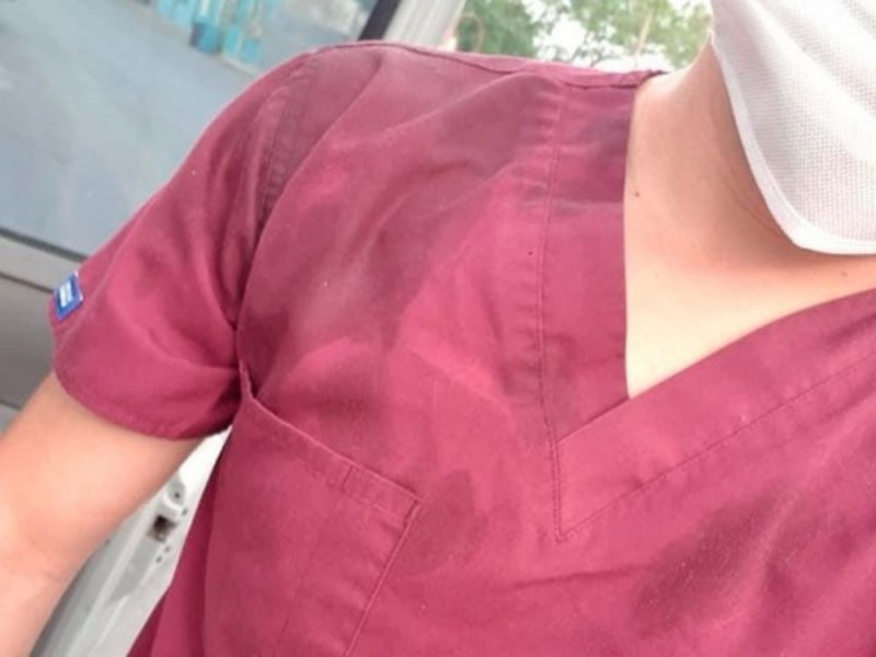 Continúan las agresiones; le arrojan café hirviendo a enfermero de Guadalajara