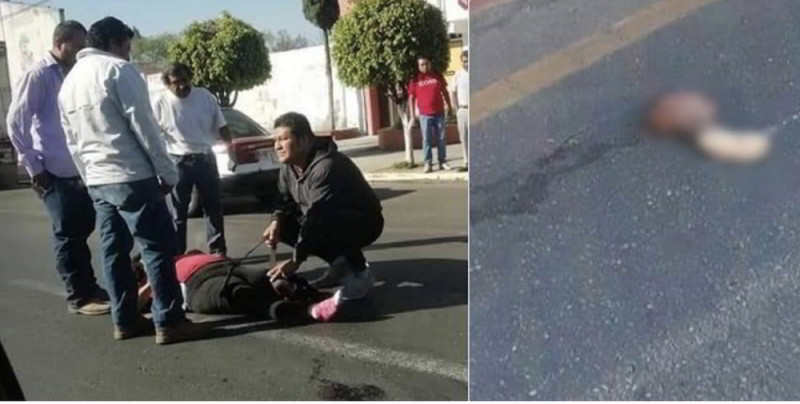 Motociclista viajando a exceso de velocidad atropella a mujer y cercenando su pierna
