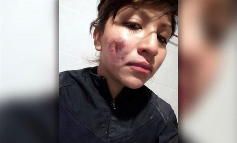 Feminista atacó con ácido en la cara a mujer policía durante marcha