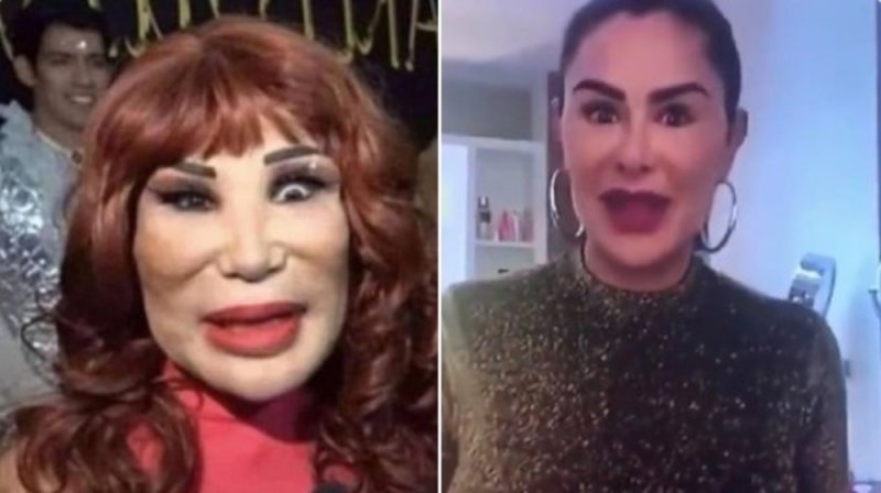 Ninel Conde y su nueva operación inundan las redes sociales con memes