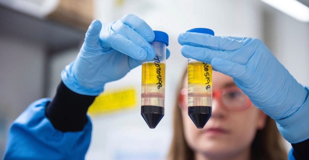 Vacuna de AstraZeneca tuvo un error de manufactura que plantea dudas sobre sus resultados