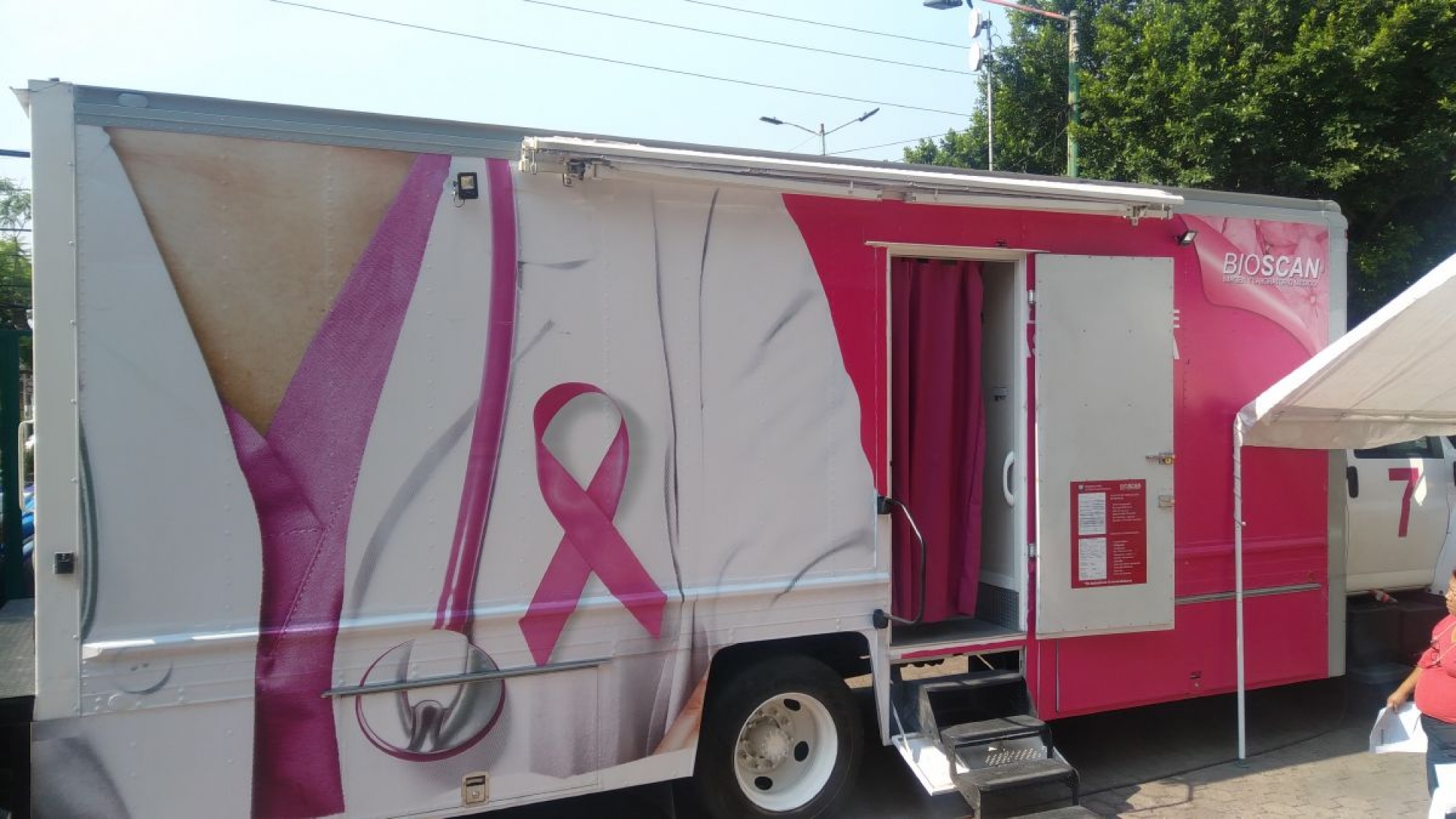 Cáncer de mama: ¿Cómo y cada cuánto tiempo debes de hacer la autoexploración?