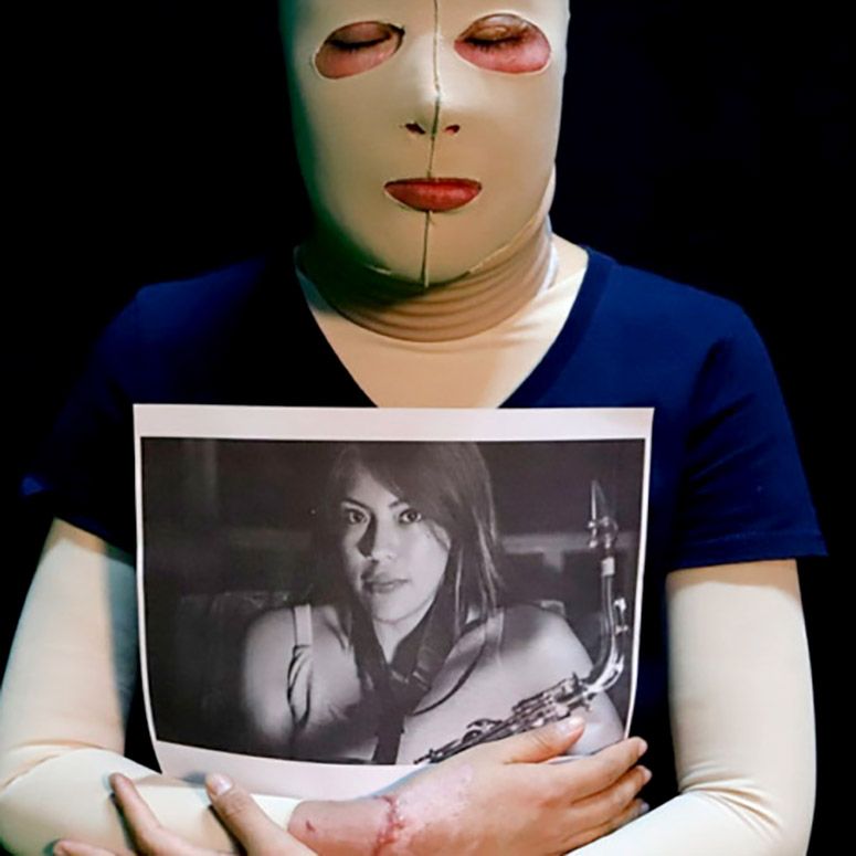 A un año de ataque con ácido, la última orden de aprehensión sigue sin ejecutarse: Elena Ríos