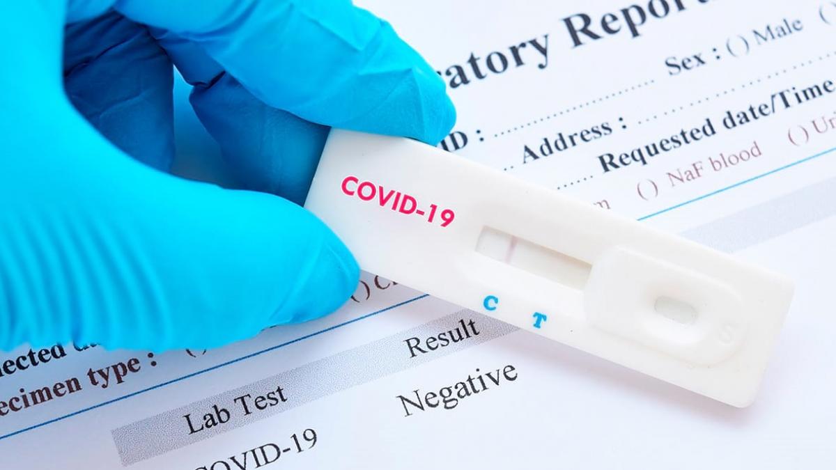 Pruebas por aquí, pruebas por allá: estos son tres tipos de exámenes para detección de COVID-19