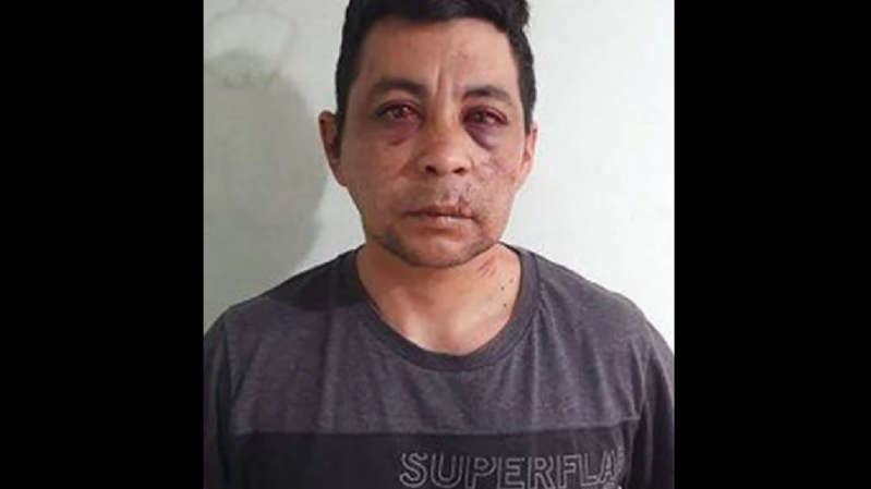 Enfermero fallece tras ser golpeado brutalmente por sus vecinos al enterarse que tenía COVID-19