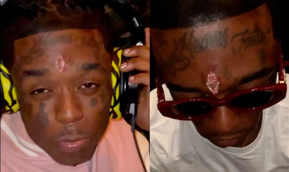 Un rapero se implantó un diamante de USD 24 millones en la frente: “La belleza es dolor”