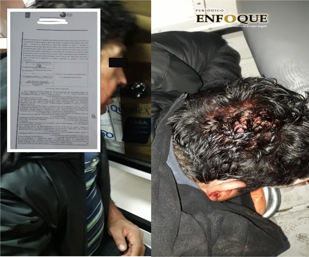 Acusan a equipo de Joel Martínez de Morena de agredir a simpatizantes del PES en Cuapiaxtla; uno de ellos se debate entre la vida y la muerte (video)