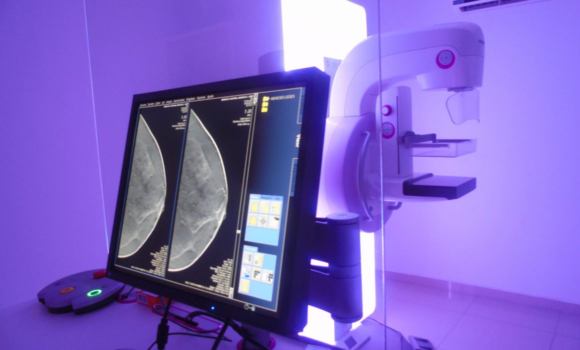 SESA refuerza campaña contra cáncer de mama