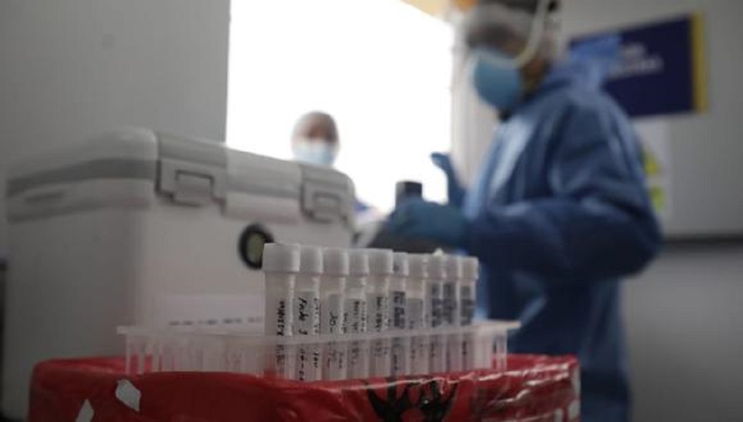 Confirman 5 nuevos casos de viruela del mono en Jalisco, ya suman 18 a la fecha