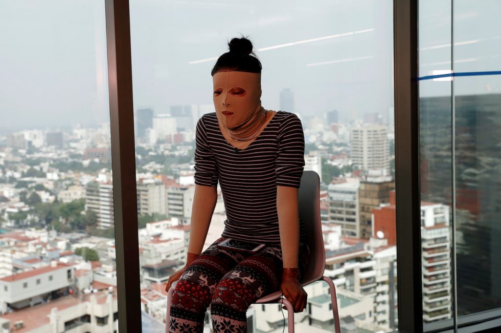 Senado aprueba penas de 7 a 13 años de prisión a quienes ataquen a personas con ácido 