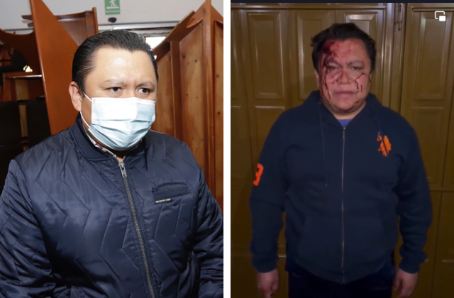 Líder del sindicato del Ayuntamiento de Puebla denuncia ataque