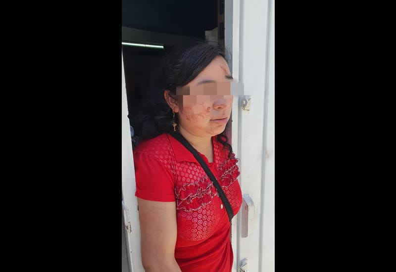 "Tras el incidente no huyo": Mujer asesina brutalmente a su pareja por golpearla e intentar abusar de ella