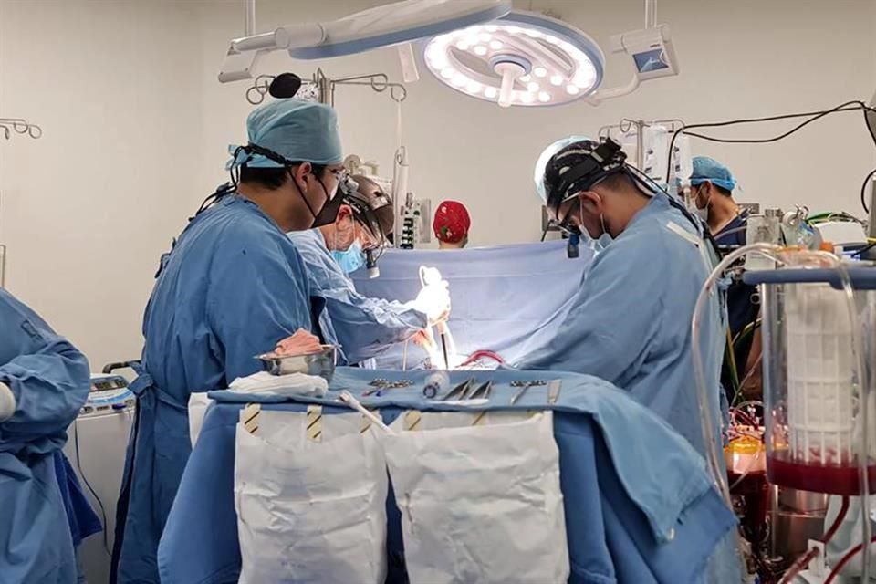 IMSS realiza el primer trasplante bipulmonar en la historia; el procedimiento fue hecho en Nuevo León
