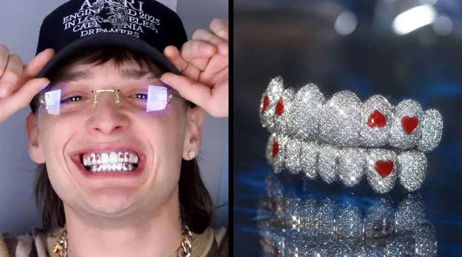 Peso Pluma estrena dentadura con incrustaciones de diamantes y este es el costo que habría pagado