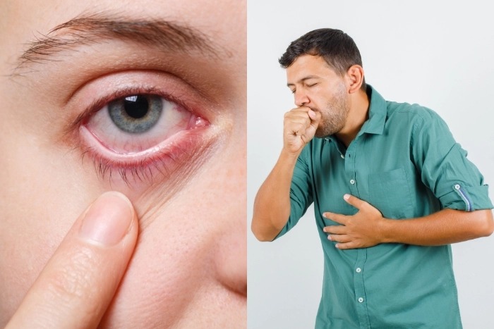 Aumentan enfermedades por la ceniza en Puebla: Centros de atención sanitaria