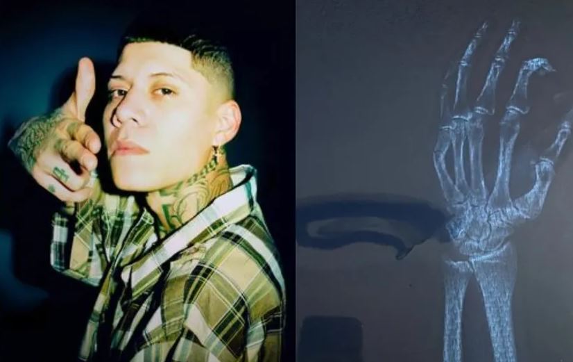 Santa Fe Klan cancela concierto tras sufrir fractura de su mano, promete regalar boletos en compensación