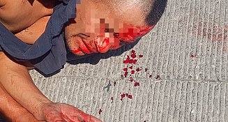 Pobladores de San Pablo del Monte detienen y dan escarmiento a presunto vendedor de drogas