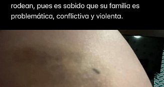 Director de PC de Apizaco por violencia física contra su pareja