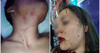 Denuncian violencia y abuso de seguridad privada en la Feria Tlaxcala