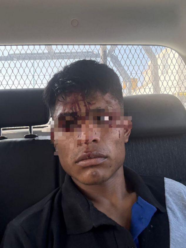 Detienen a “El Pechos” tras balear a un hombre en Zacatelco; pleito familiar habría detonado la agresión