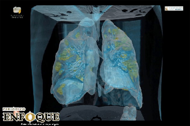 Video en 3D muestra cómo ataca el covid-19 a los pulmones 