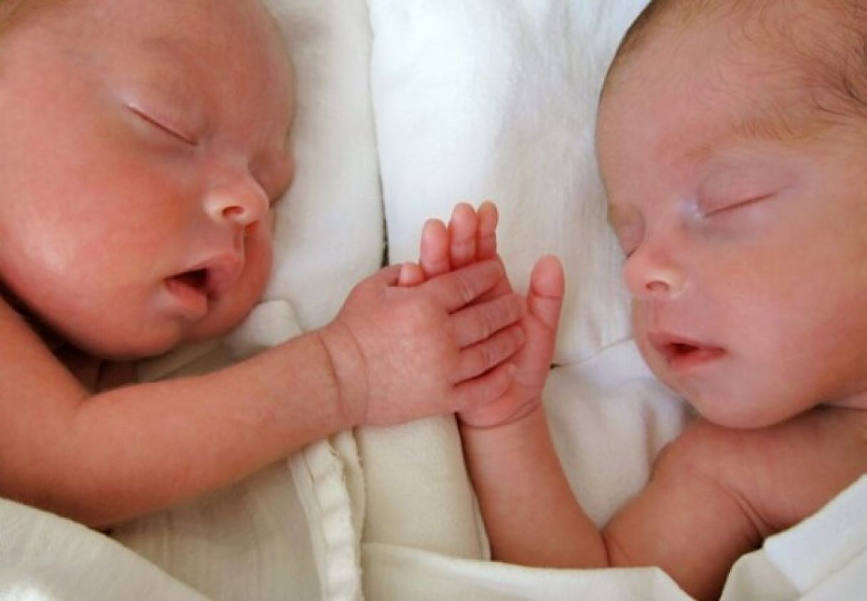 El increíble nacimiento de mellizos de padres diferentes en Latinoamérica