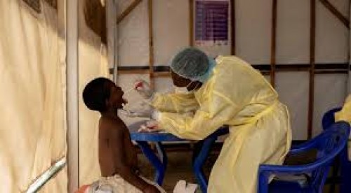 Urge donar vacunas contra mpox en África 