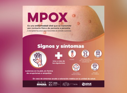 Secretaría de Salud capacita a profesionales para enfrentar mpox: prevención y diagnóstico clave