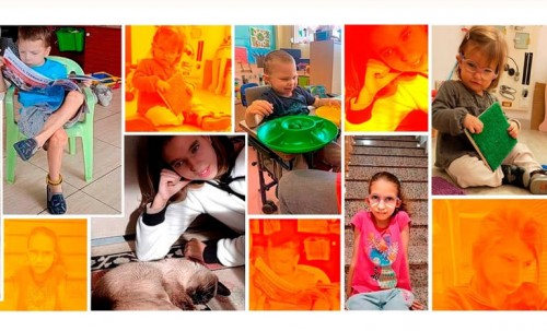 ¿Qué es el Síndrome DYRK1A?; conoce sus principales síntomas