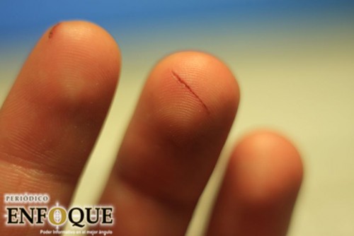 ¿Por qué cortarse con papel duele mucho?