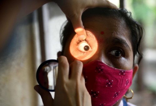 México registra primera muerte por mucormicosis, la enfermedad del ´Hongo Negro´