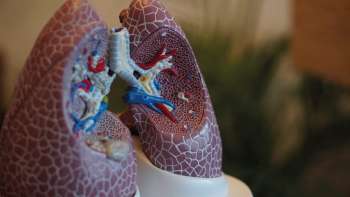 Acumulación del virus en pulmones, podría causar muerte tras covid-19
