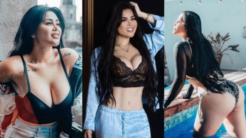 Araceli Ordaz impacta con los resultados de sus últimas cirugías y afirma que serán las últimas (Vídeo)